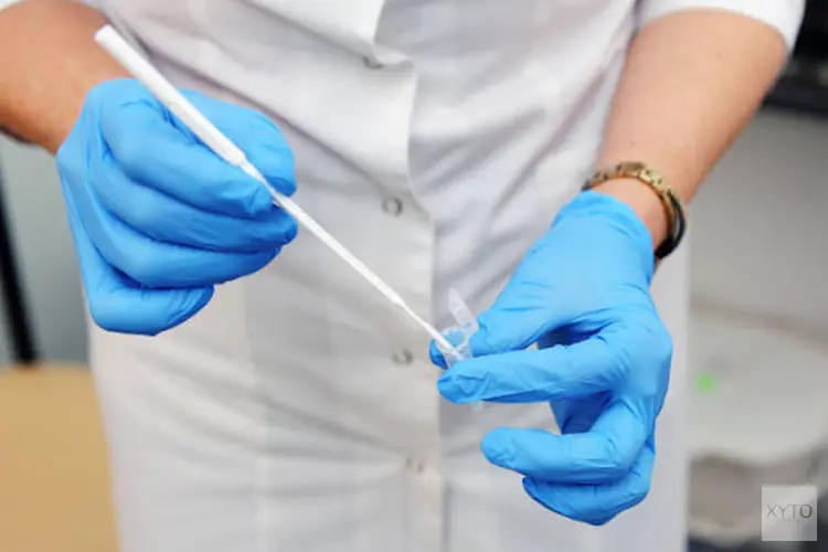 Soa test op Chlamydia: Zorg voor je lichaam en gezondheid